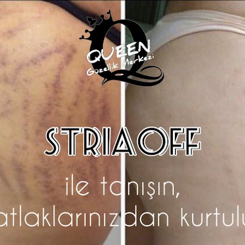 KONYA ESTETİK MERKEZİ